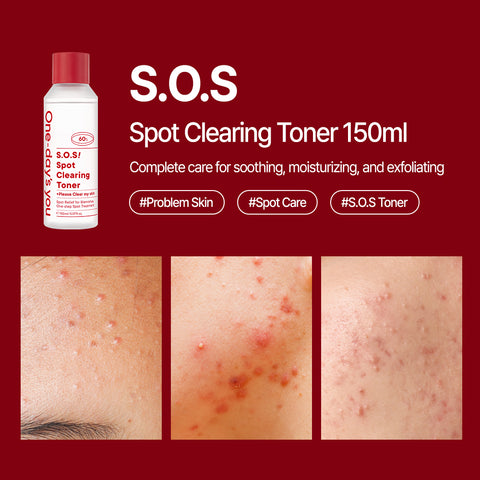 [One-day's you] S.O.S! SPOT CLEARING TONER 150ml K-Beauty